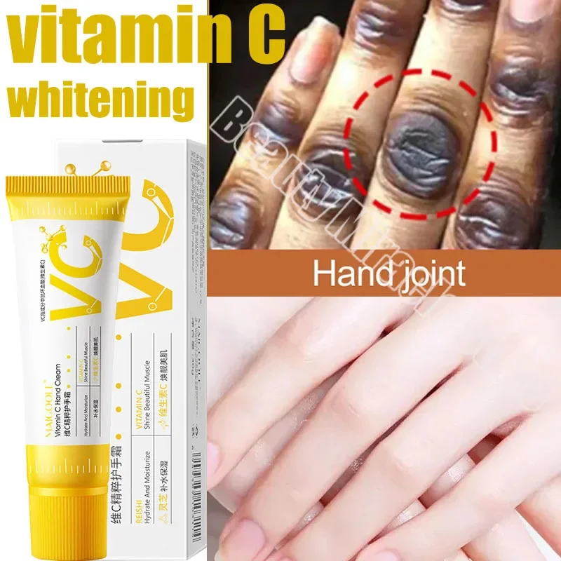 Fast Whitening Dark Knuckles Brighten Hand Cream Melanin Corrector Moisturizing Intense Stains Remover Products Skin Care whitening lotion