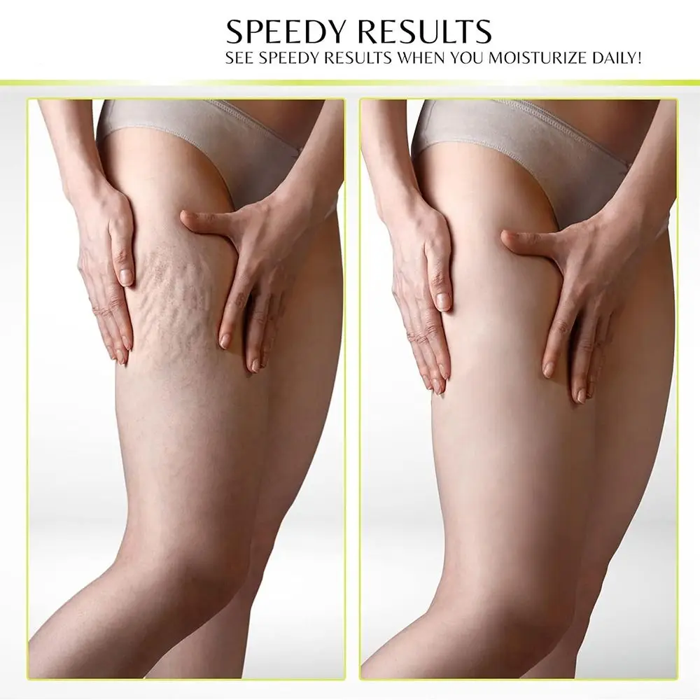 Collagen Retinol Collagen Face Cream Hyaluronic Acid Vitamin C Firming and Brightening Body Lotion Anti Aging Hydrating