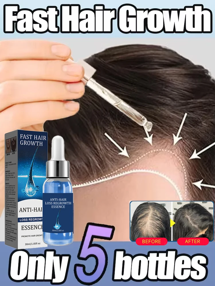 Hair Growth Serum Fast Hair Growth Oil Effective Baldness Repair Hereditary Hair Loss Postpartum Loss Seborrheic