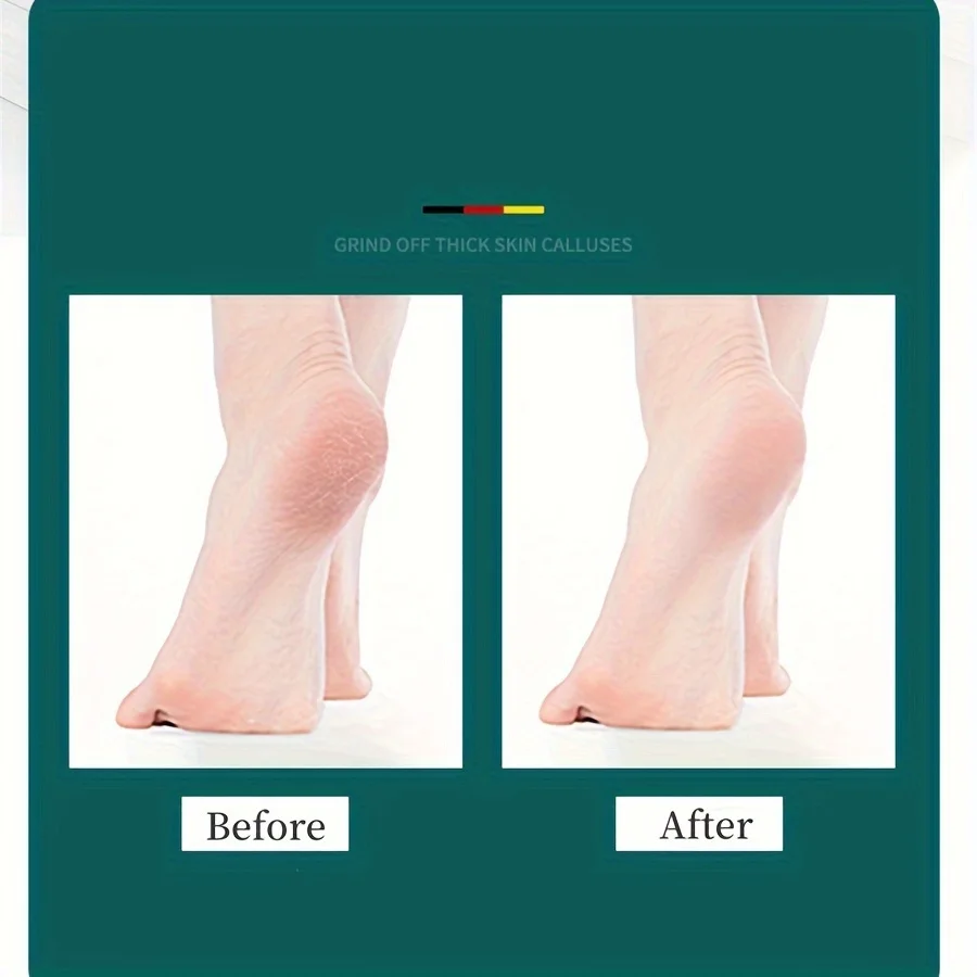 High Quality Foot File Double Sided Callus Remover For Dead Skin Professional Pedicure Tools Callous Scraper Sander Heel Filer 6