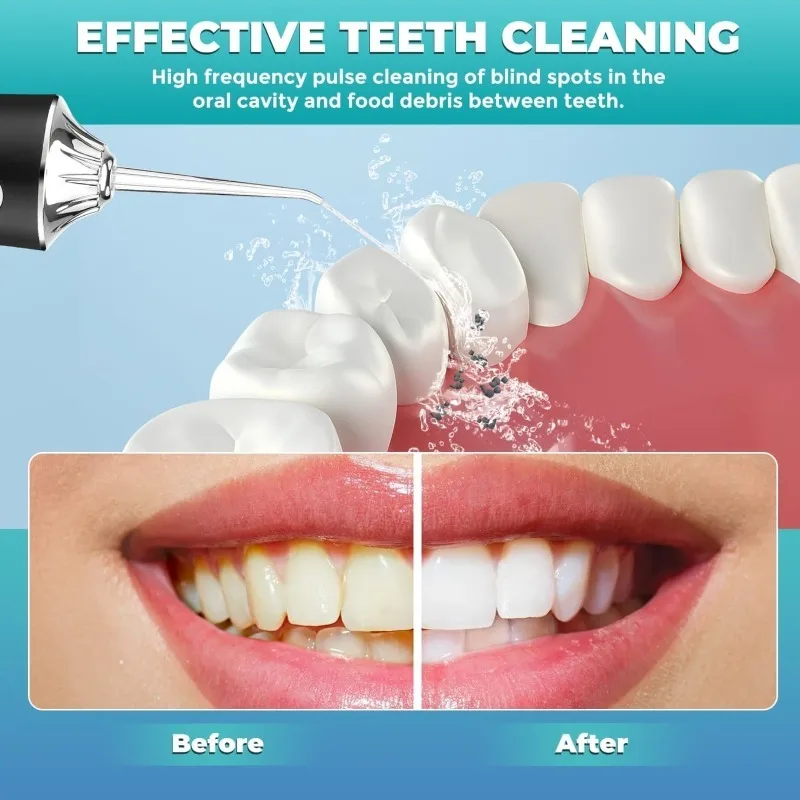 Dental Water Flosser Oral Irrigator Portable USB Rechargeable Dental Water Flosser 4 Jet Tip 220ml 3 Modes IPX7 Waterproof