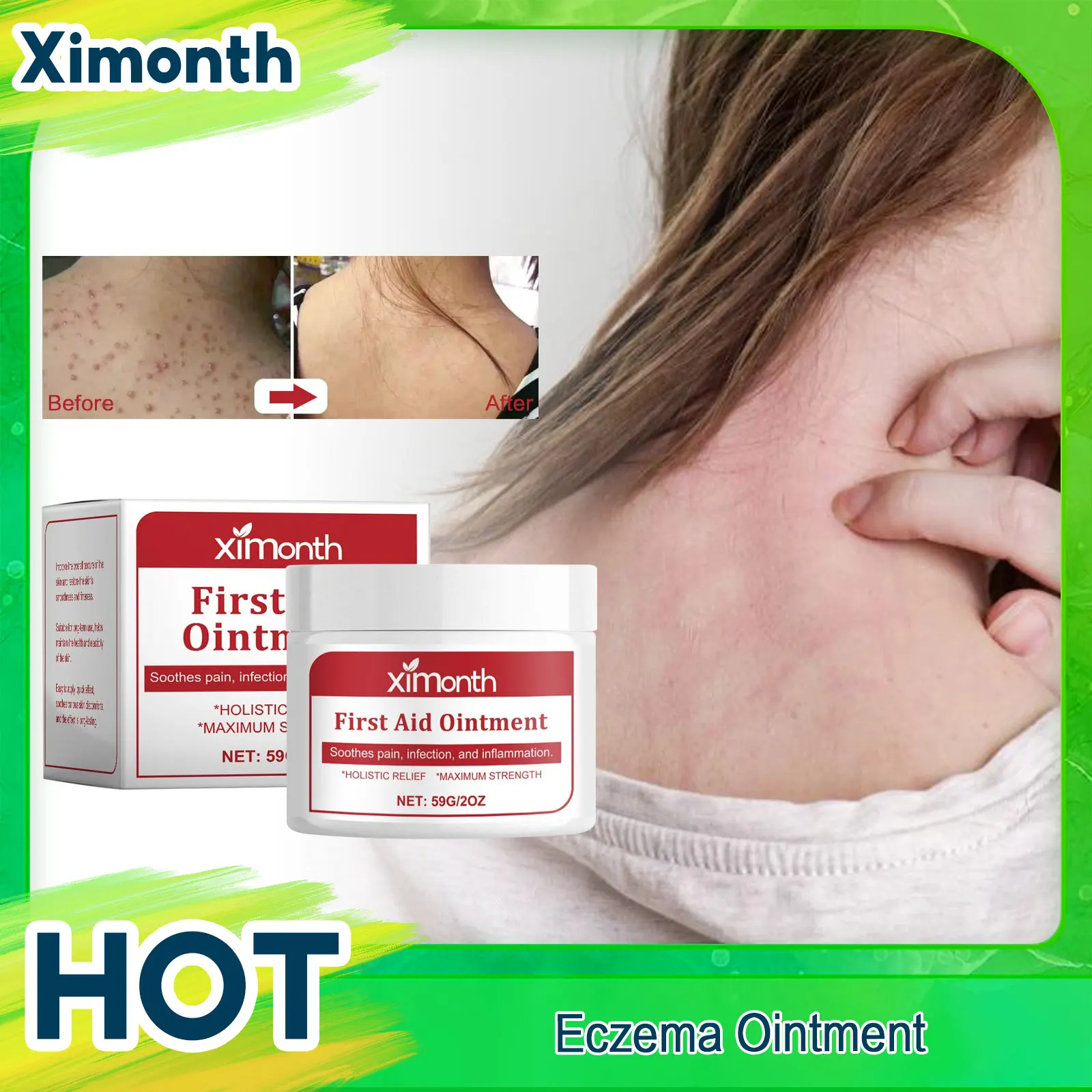 Repair Psoriasis Ointment Relieve Skin Itch Dryness Rash Desquamation Anti Fungus Treat Folliculitis Urticaria Hypersensitivity