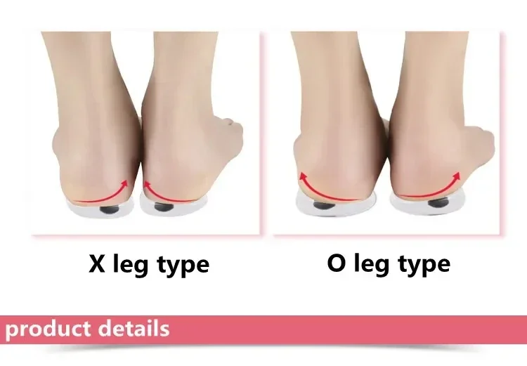 1Pair Orthopedic Insoles for Feet O/X Leg Type Valgus Correction Men Women Silicone Gel Shoes Insole Magnet Massage Shoe Pads