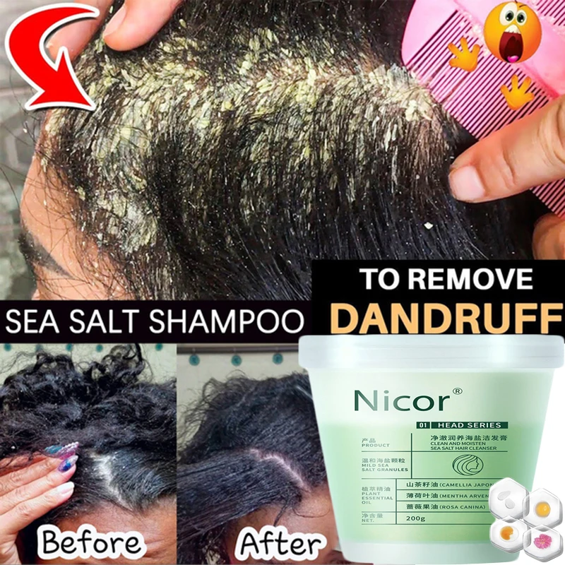 200gPowerfulDandruffScrubCreamNaturalSeaSaltShampooforItching
