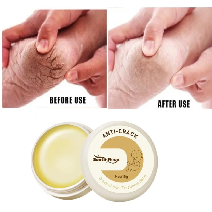 

Anti Cracked Heel Treatment Cream Herbal Anti-Drying Removal Callus Dead Skin Balm Hand Foot Mositurizing Repair Skin Care Mask