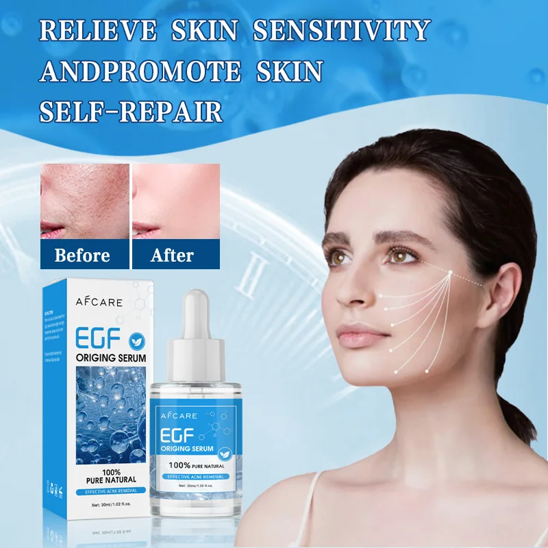 Oligopeptides Acne Removal Serum Repair Acne Serum Oil Shrink Pore Remove Blackheads Facial Cleaning Fade Marks Whitening