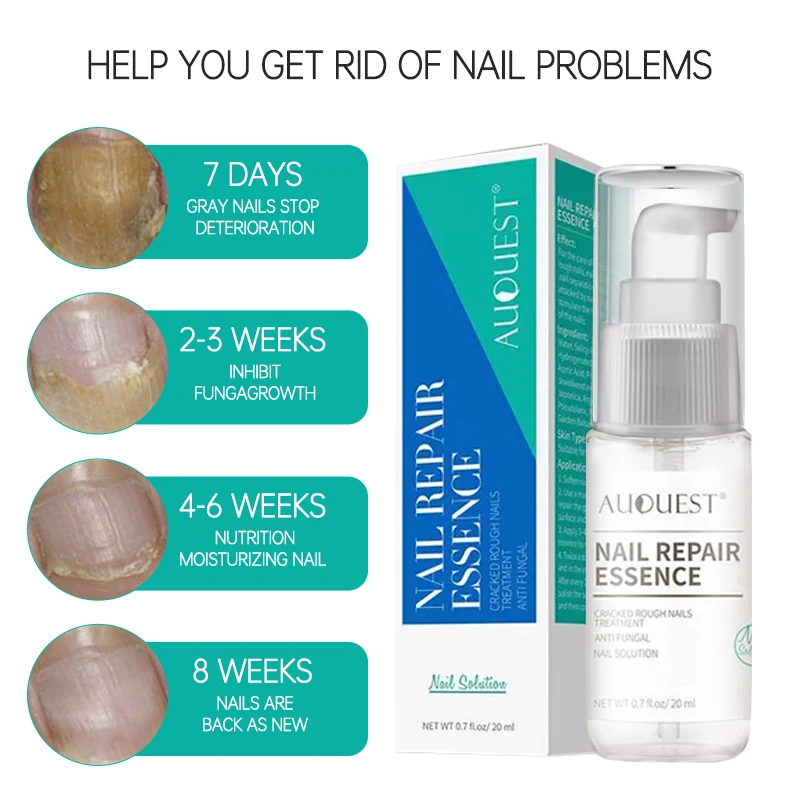 best nail fungus treatment