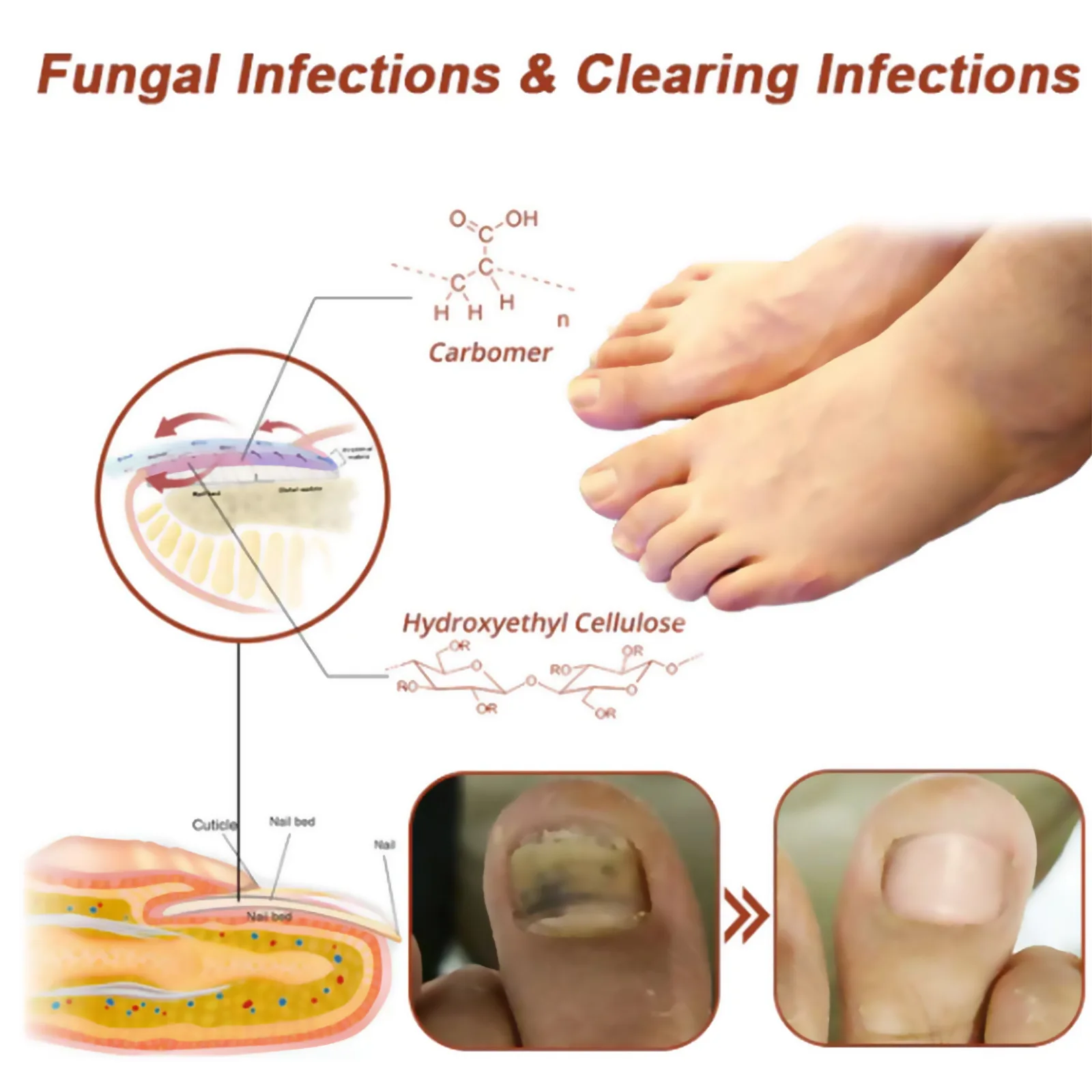 Fungal Nail Laser Device Fast Repair Nails Fungus Onychomycosis Toenail Fingernail Removes Nail Fungus Foot Care Cure Ingrown