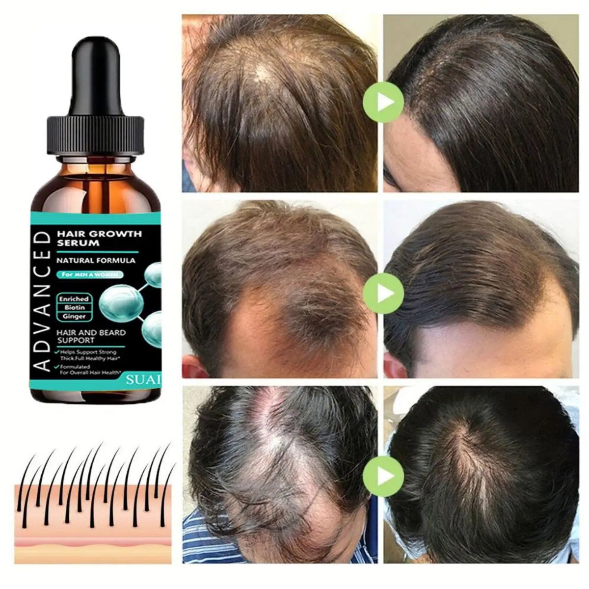 Hair Growth Serum for Men Essential Oil Hair Repair Furcation Protection Anti-hair Loss Beard