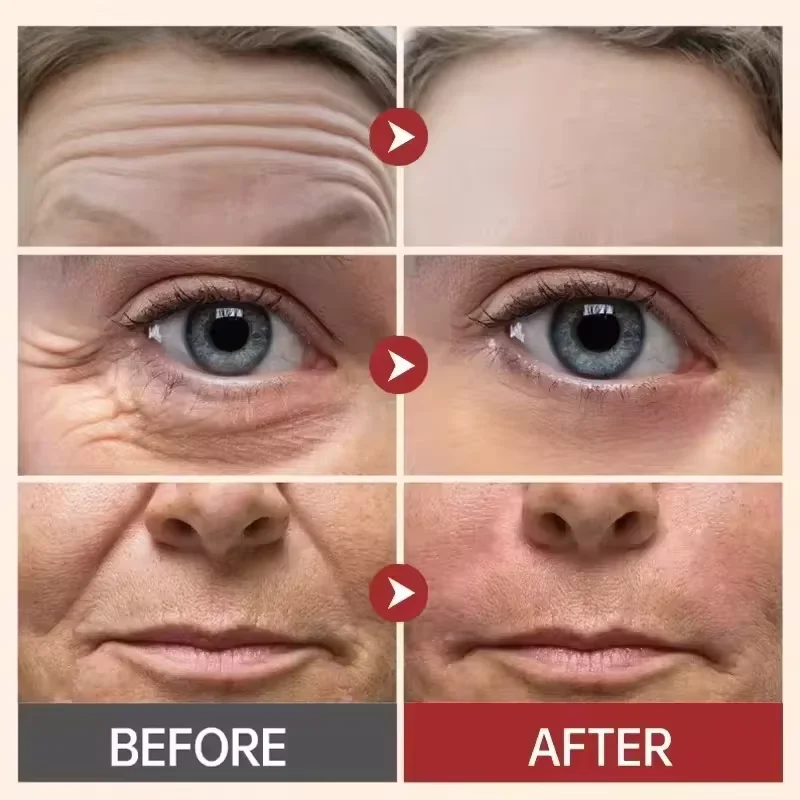 Pure Hyaluronic Acid Remove Wrinkle Face Serum Firming Lift Anti-Aging Serum Fade Fine Lines Improve Puffiness Korean Skin Care 3
