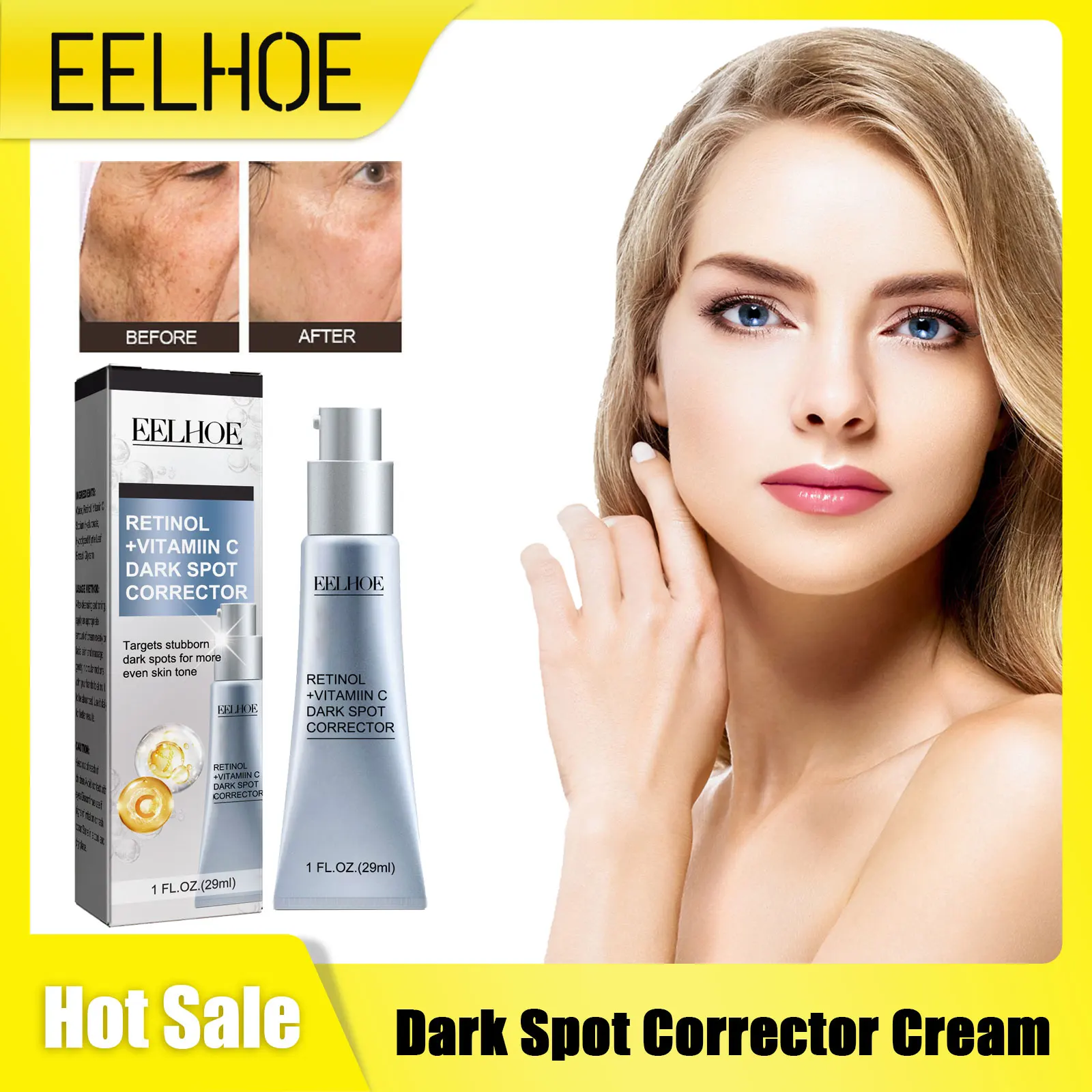 

Whitening Freckles Cream Melasma Dark Spot Remover Lighten Melanin Chloasma Fade Pigmentation Moisturize Brighten Face Skin Care