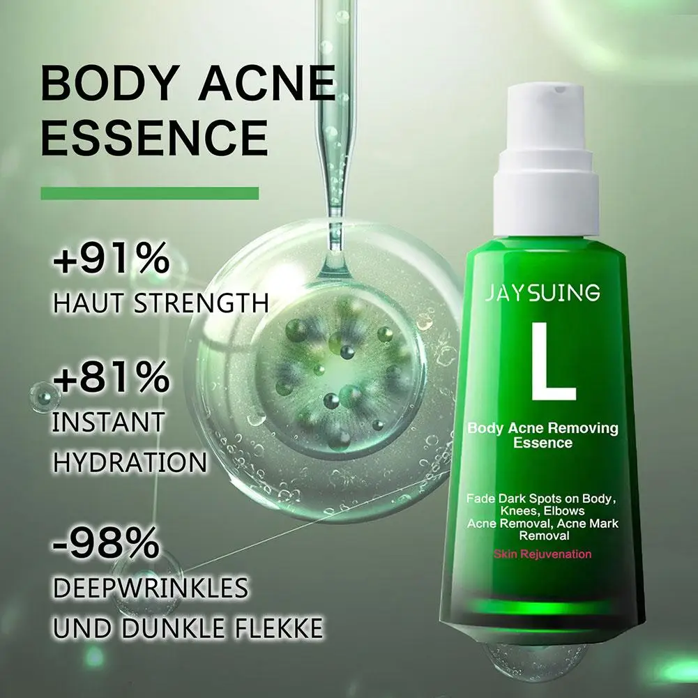 30ml Acne Remover Face Serum Herbs Acne Treatment Pimple Remover Shrink Pores Oil Control Face Herb Acne Skin Care_voghion.com
