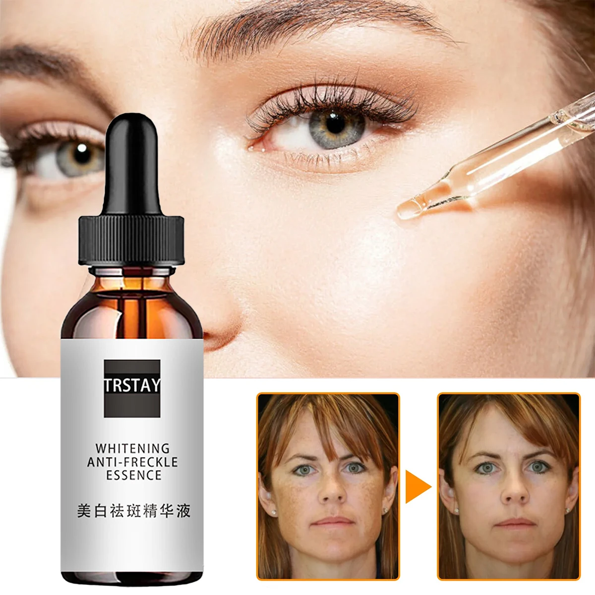 NiacinamideAcidFacialEssencesDeepMoisturizingNiacinamideAcid