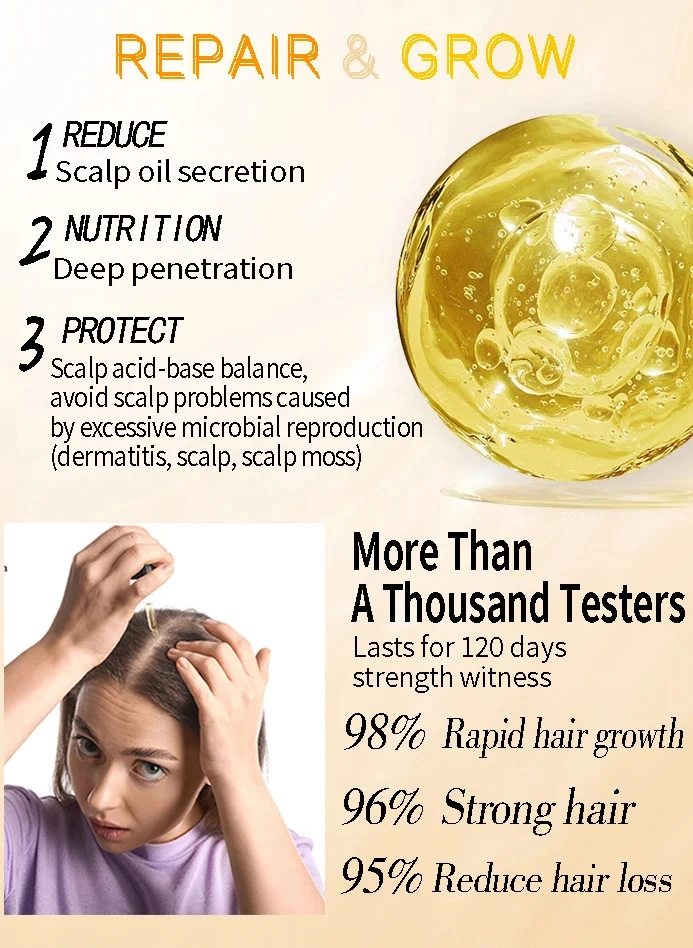 Description Picture 2 of itemHair Growth Spray Anti Hair Loss Essence Hair Regrowth Serum Treatment Alopecia Prevent Baldness Nourish Scalp 30ml