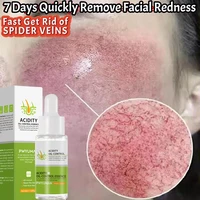 Repair Facial Redness Serum Instant Spider Vein Remove Sensitive Skin Sooth Anti Redness Rosacea Treat Lotion Korean Cosmetics 1