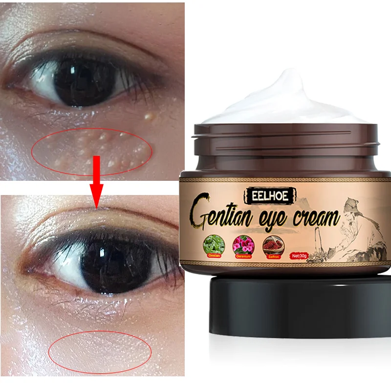 

Removes Fat Granules Eyes Cream Improve Eye Bag Dark Circle Eye Fine Line Lifting Firming Moisturizing Anti-Puffiness Eye Care