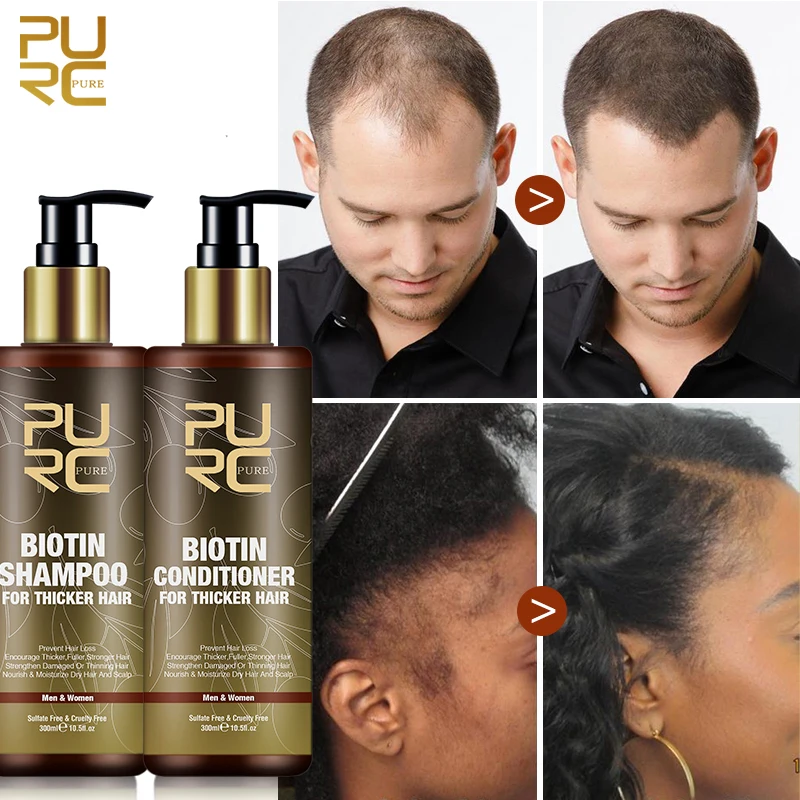 Purc Biotin Hair Growth Shampoo Products Hair Treatment Anti Loss Scalp  Repair Regrowth Biotin For Hair Growth Men Women Shampoo - Hair Loss  Product Series - AliExpress