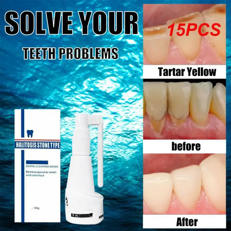 

Calculus Cleaning Halitosis Stone Type Remove Teeth Whitening Cleaning Water Remove Peculiar Smell and Calculus