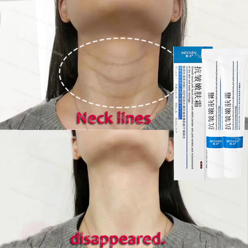 Neck Cream Collagen Eliminate Neck Wrinkle Lines Lifting Whitening Tighten Double Chin Anti-age Rejuvenation Skin Care Product