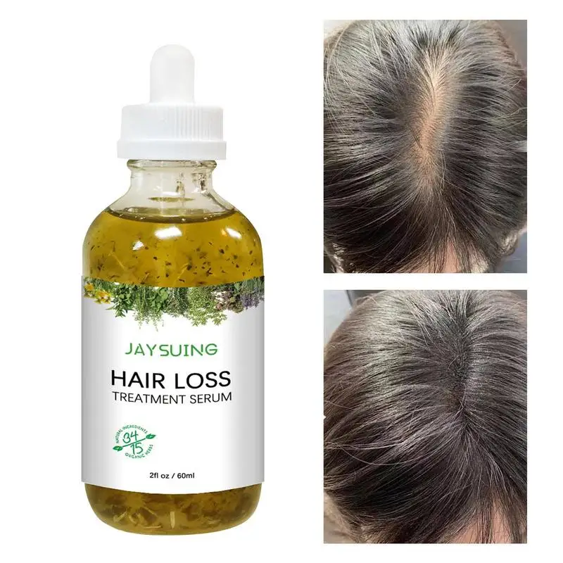 Hair Thickening Oil Hair Loss Care Oil 2oz Hair Oil For Dry Damaged
