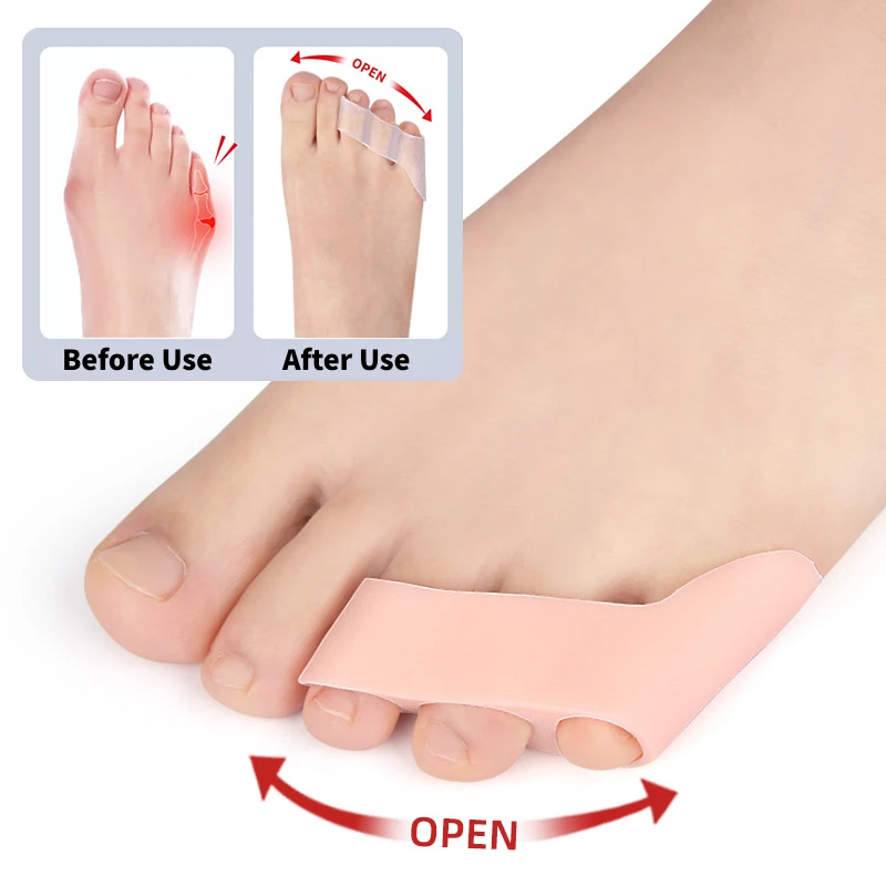 2Pcs=1Pair Toe Separator Separateur D'ortei Hallux Valgus Corrector 3 Hole Small Bunion Orthotics Protector Pedicure Adjuster toe separators,toe spreader,toe corrector,finger toe separator,toe protectors