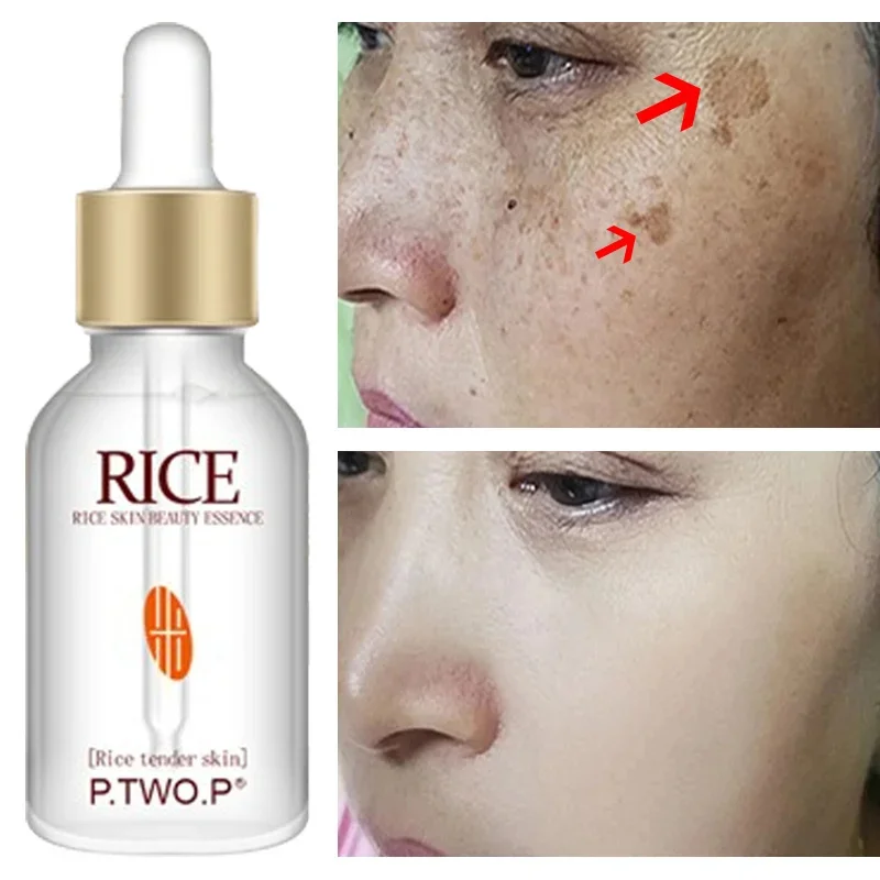 Brightening Serum For Face Korean Product Dark Spot Freckle Remover Lighten Acne Mark Whitening Improve Dullness Moisturize Skin nicotinamide whitening serum lighten acne marks shrinking pores improve roughness skin brightening moisturizing facial essence