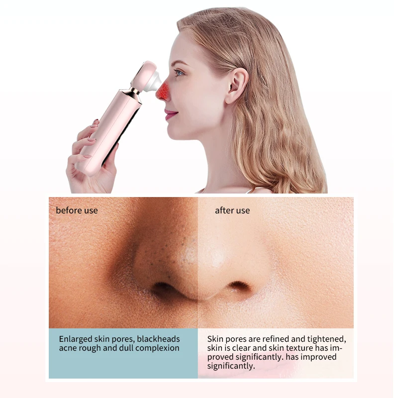 Electric blackhead remover, USB rechargeable, men's and women's facial blackhead removal instrument 6