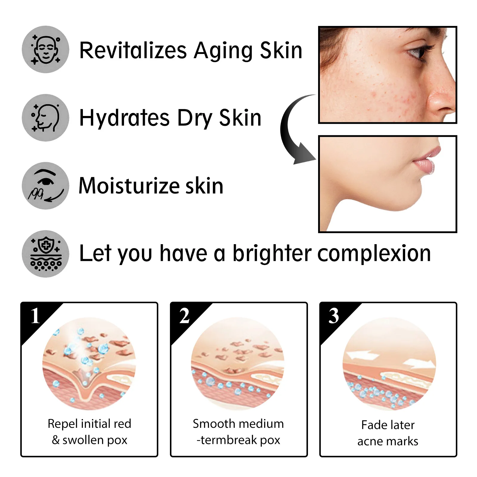 Snail 92 All in One Cream Tighten Facial Skin Anti Aging Whitening Fade Dark Eye Circles Remove Eye Bags