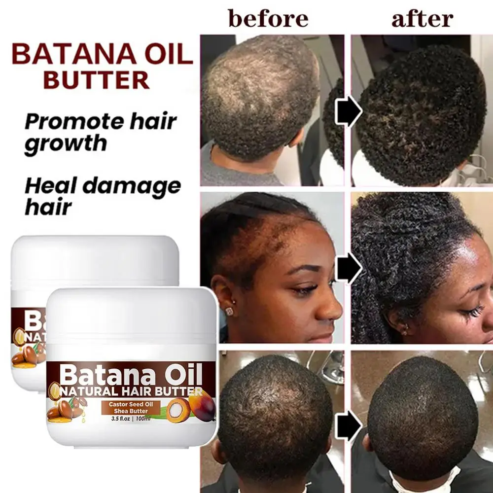 Description Picture 6 of itemNatural Pure Batana Oil For Hair Growth Batana Oil Butter Hair Mask Hair Loss Treatments For Black Men & Women 100ml