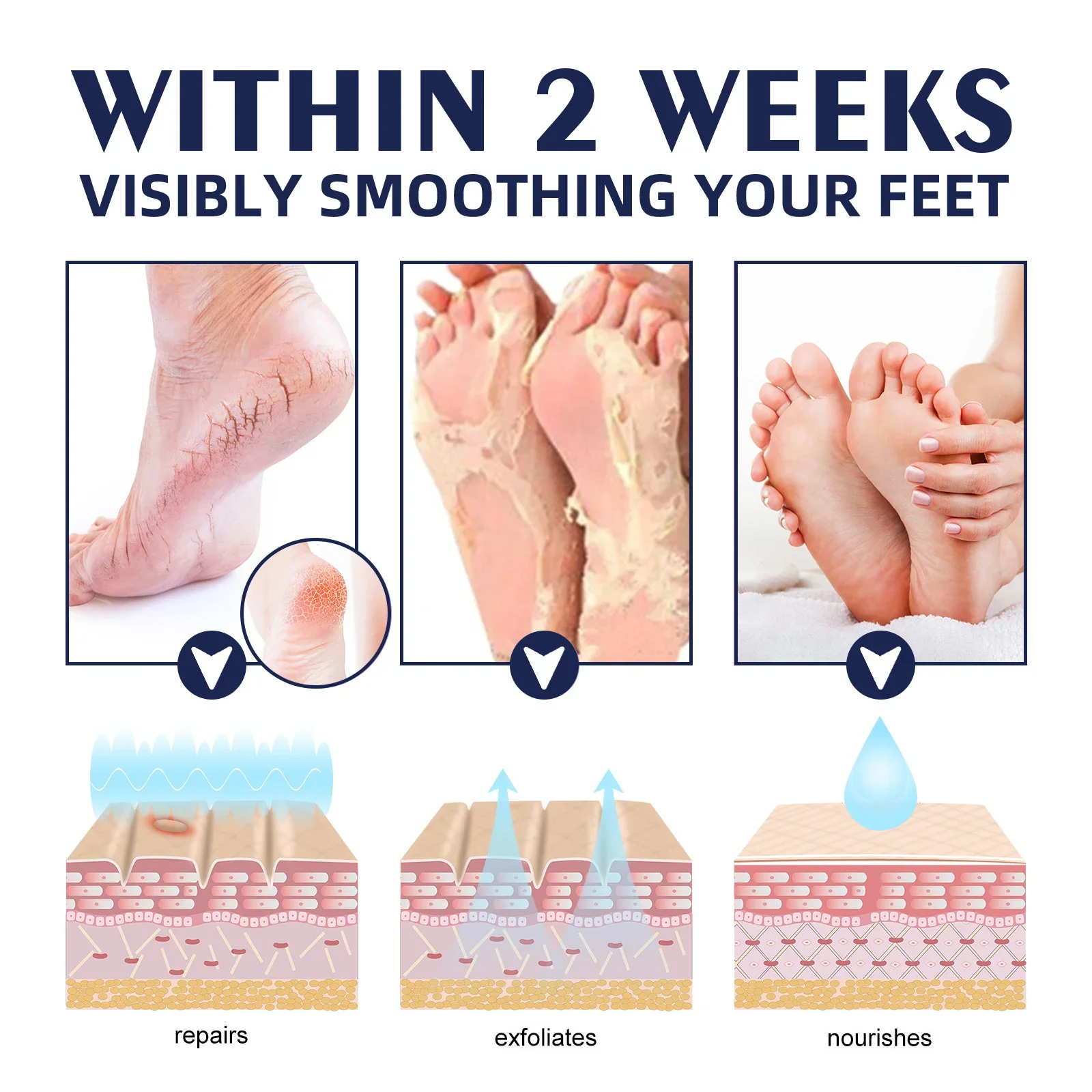 Hand and Foot Cream 40g Anti-dry and Cracked Feet Heel Crack Repair Moisturizing Whitening Removing Dead Skin