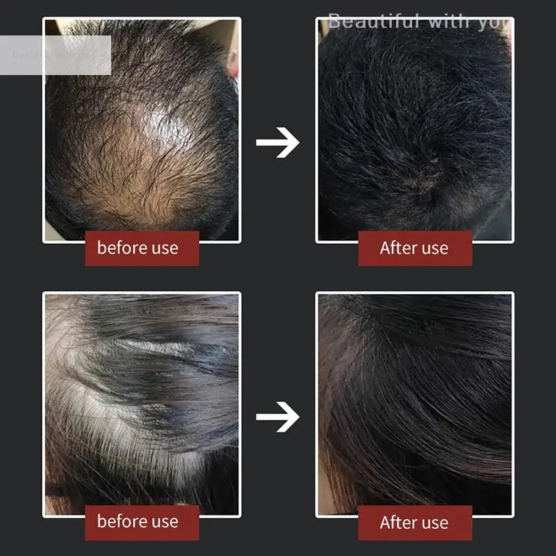 Hair Fibers Powder Special Comb Hair Loss Building Fibers Line Optimizer Thickening hair building powder hair building fibers