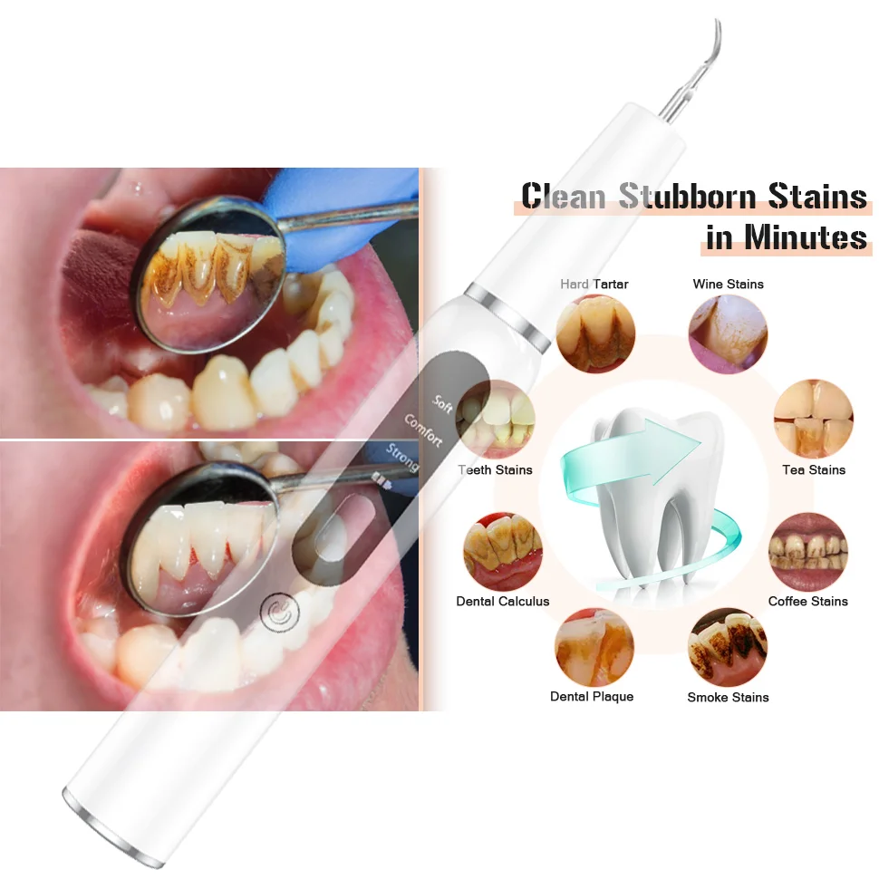 Ultrasonic Dental Scaler For Teeth Tartar Stain Tooth Calculus Remover Electric Sonic Teeth Plaque Cleaner Dental Stone Removal 2