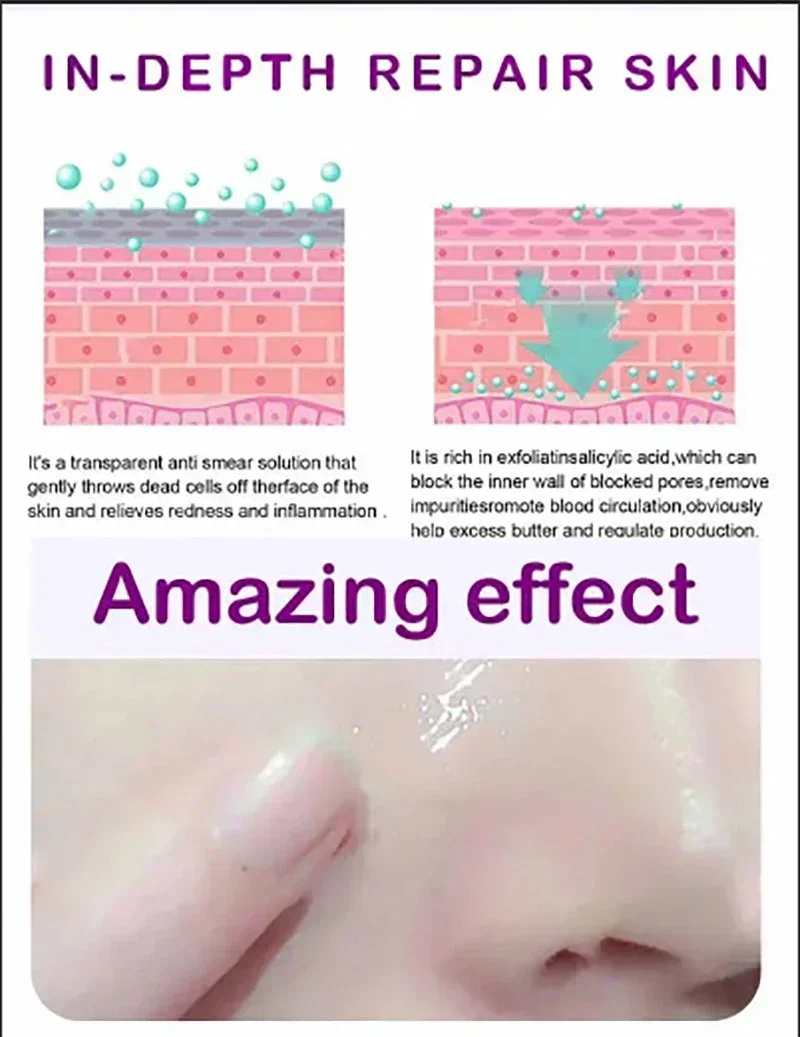 Pore Shrinking Serum Moisturizing Facial Essence for Relieving Dryness Oil Long-lasting Calming for Sensitive Skin Care 6