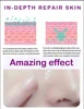 Pore Shrinking Serum Moisturizing Facial Essence for Relieving Dryness Oil Long-lasting Calming for Sensitive Skin Care 6