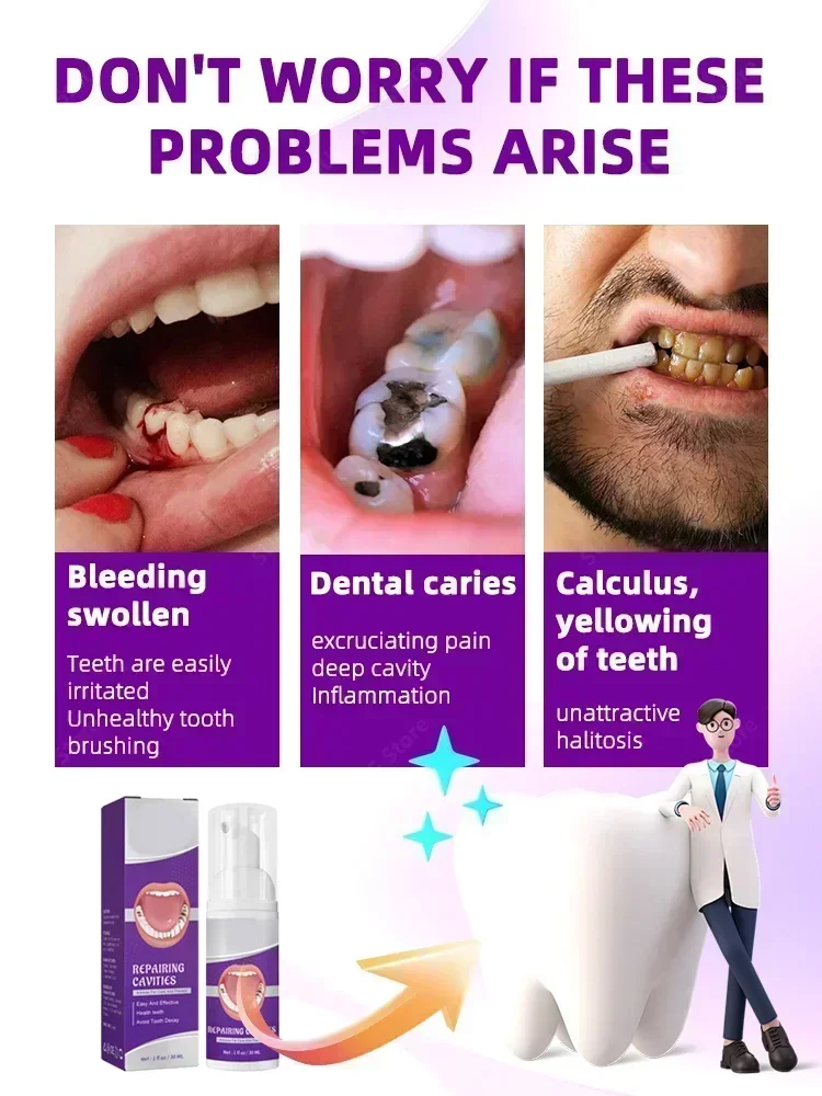 Dental paste Prevent Tooth Decay Dental Caries Whitening Teeth Fresh Breath Repair Tooth Decay Teeth Whitening Product Teeth Whitening Essence Teeth Health Product