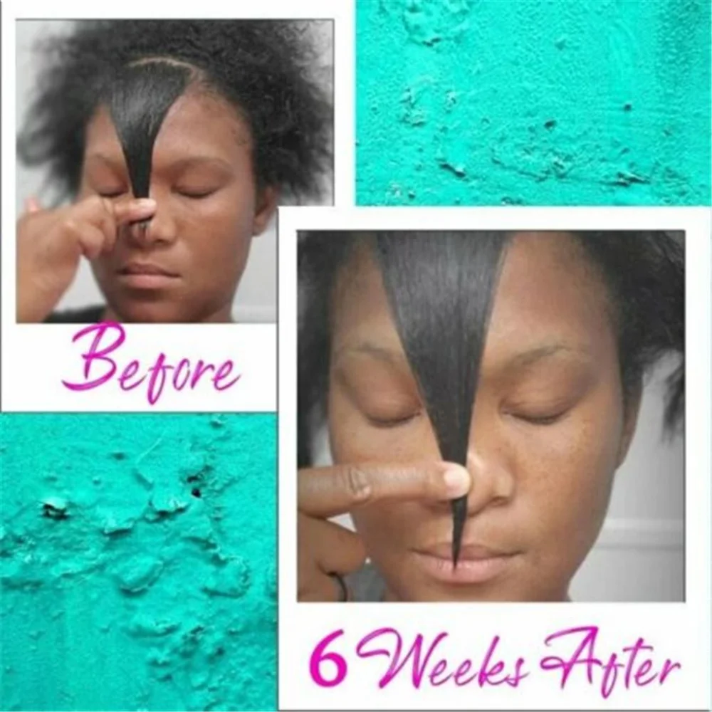 Alopecia Hair Treatment for Women for Fast Hair Growth Serum Care Essential Oil for Black Women Beard Oil