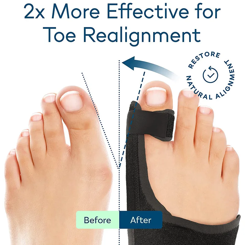 Orthopedic Bunion Splint Corrector Big Toe Separator Pain Relief Non-surgical Hallux Valgus Correction Hammer Toe Straightener 2