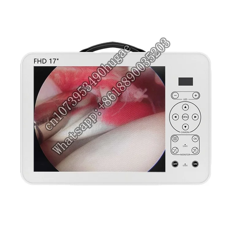 Endoscopia Portatile Medica Orl Fhd O Videocamera Chirurgica Dal Prezzo Di Vendita Diretta In Fabbrica Di Brank