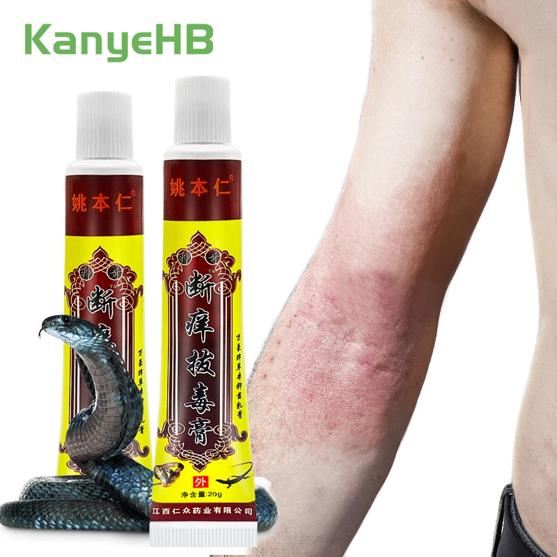

2Pcs Psoriasis Dermatitis Eczematoid Eczema Ointment Natural Plant Extract Anti-Itch Chinese Herb Medical Skin Care Cream A253