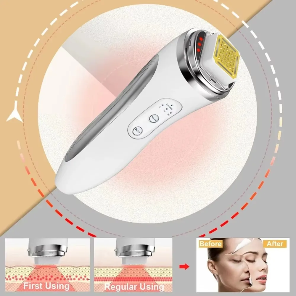 Radio Frequency Facial Lifting Machine Dot Matrix Wrinkle Removal SKin Tightening RF High Frequency Facial Care Massager Device 4