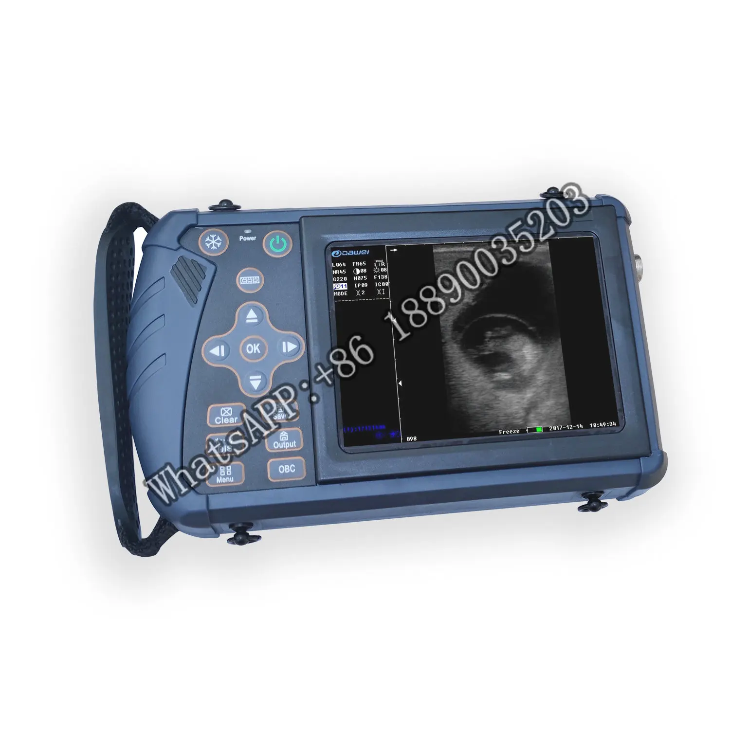 

Cheap Animal Pet Dog Vet Farm Ultrasound 5.6 Inches Scanner