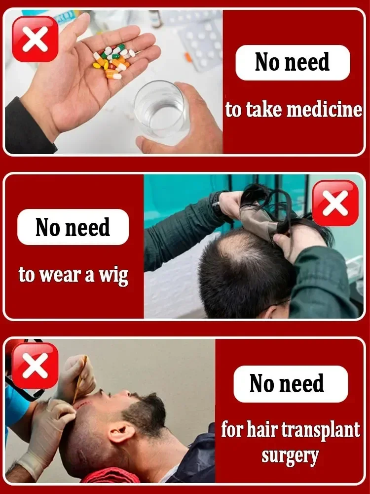 Nick-Hair care beauty, quality of damaged hair, strengthening of the complexion and improvement losses