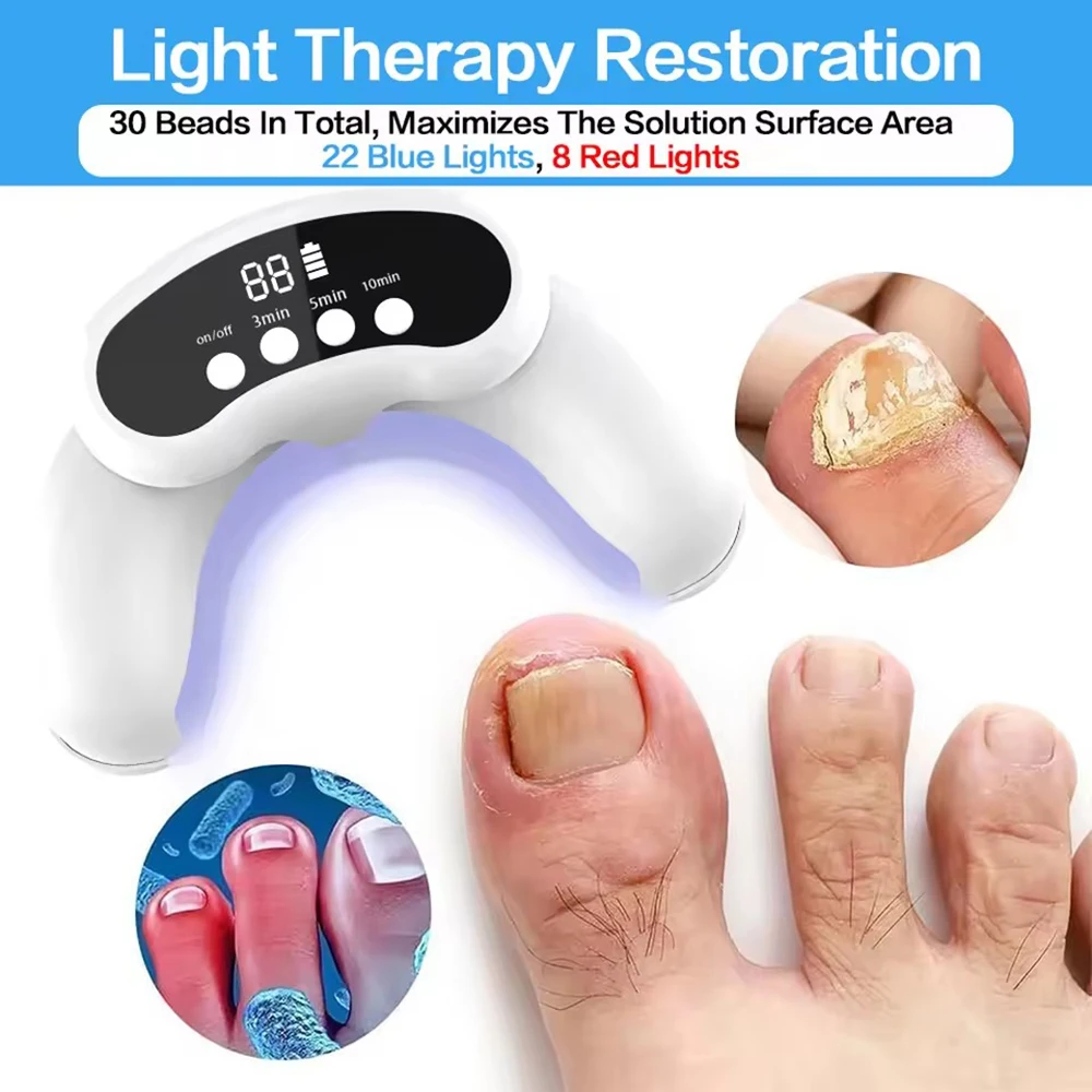 Nail Fungus Laser Treatment Device Fingernail Fungus Treat Onychomycosis Therapy Effectively Remove Onychomycosis Grow Toe Nail
