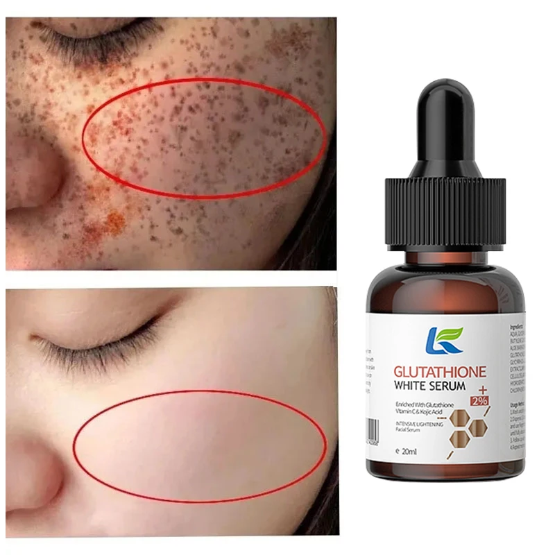 Whitening Serum Fade Dark Spot Freckle Brighten Essence Remove Pigment Melanin Correcting Beauty Face Skin Care