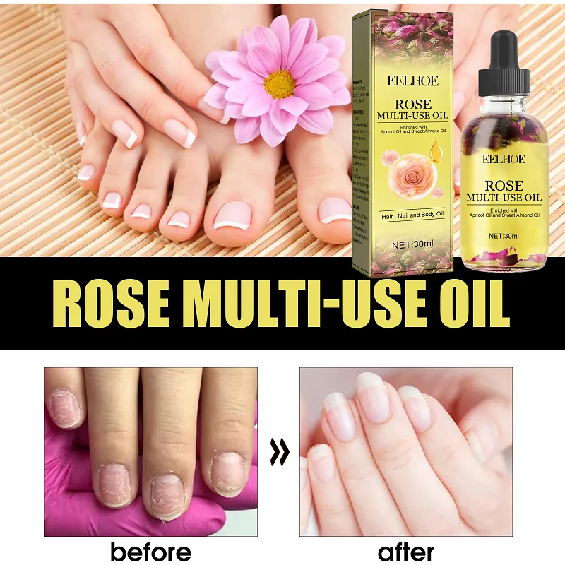 

30ml Eelhoe Rose Pets Essential Oil Moisturizing Body Skin Hair Care Foot Anti-Chapping Multi-Effect Skin Deep Repair Beauty