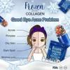 Autocollant Anti-continuité Au Collagène Congelé, Éclaircissant, Anti-acné, Taches De Rousseur, Brillant Pour La Peau, 300 Pièce 3