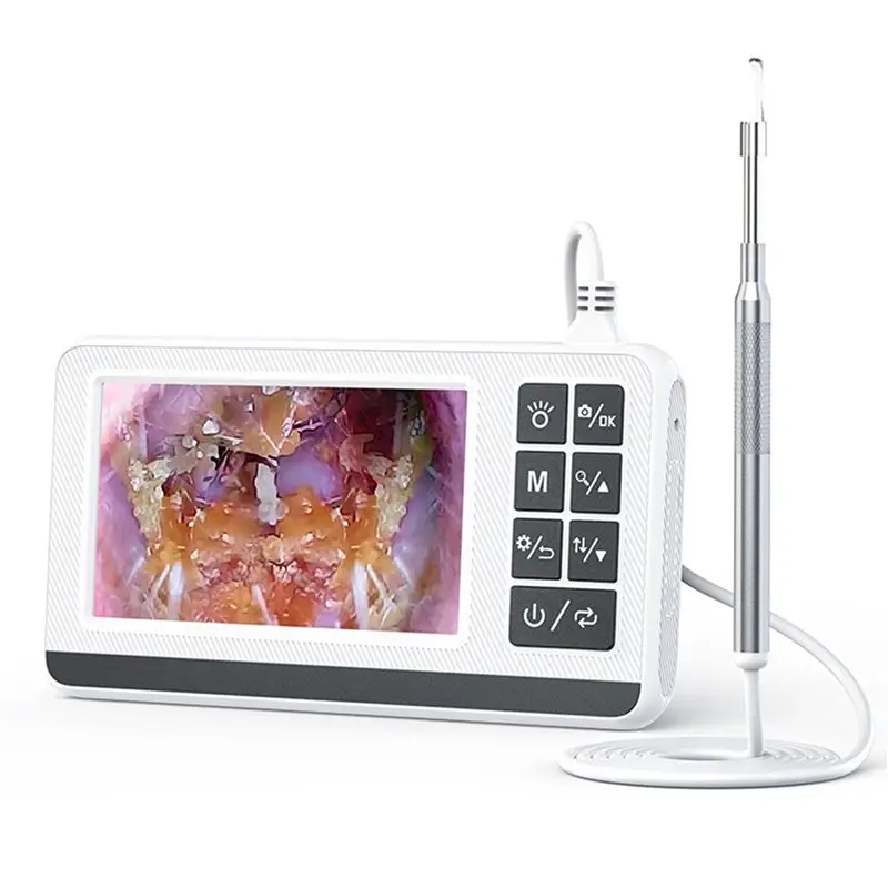 ABGI-2X Cucchiaio per orecchie digitale con luce visibile, fotocamera per orecchie otoscopio, detergente per orecchie intelligente - immagine 2