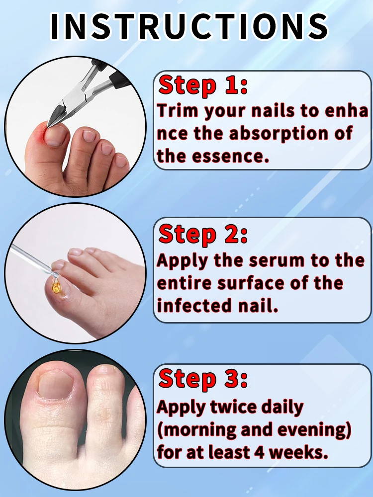 Ingrown nail nippers, toenail clippers, deep nail groove manicure tools, help essential oil absorption, solve problems