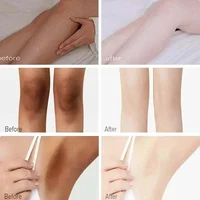 Crème blanchissante pour le corps, parties intimes, aisselles, genoux, cuisses, mélanine intérieure, Lotion éclaircissante, peau foncée, soins pour le corps blancs sains 5