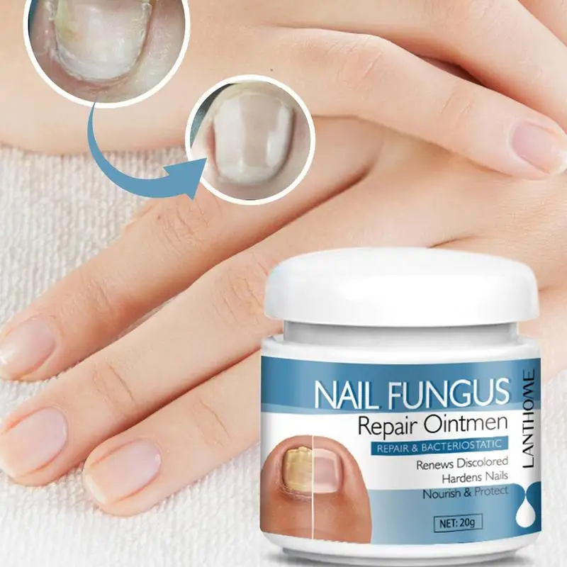 

Nail Fungall Solution Renew Nail Damaged Skin Anti Contagion Paronychia Onychomycosis Funguss Removal Serum Gel For Nail